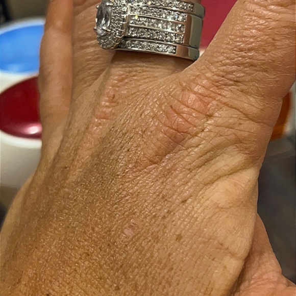 RING 💍 - Picture 3 of 6